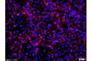 Formalin-fixed and paraffin embedded mouse melanoma labeled with Anti- MITF Polyclonal Antibody, Unconjugated (ABIN676373) at 1:200 followed by conjugation to the secondary antibody Goat Anti-Rabbit IgG, PE conjugated used at 1:200 dilution for 40 minutes at 37°C and DAPI (MITF antibody  (AA 351-450))