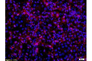 Formalin-fixed and paraffin embedded mouse melanoma labeled with Anti- MITF Polyclonal Antibody, Unconjugated (ABIN676373) at 1:200 followed by conjugation to the secondary antibody Goat Anti-Rabbit IgG, PE conjugated used at 1:200 dilution for 40 minutes at 37°C and DAPI (MITF antibody  (AA 351-450))