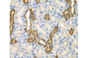 Immunohistochemistry of paraffin-embedded Mouse kidney using CNPY3 Polyclonal Antibody at dilution of 1:100 (40x lens). (TNRC5 antibody)