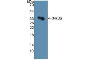 Detection of Recombinant GP1Ba, Human using Polyclonal Antibody to Cluster Of Differentiation 42b (CD42b) (CD42b antibody  (AA 19-291))