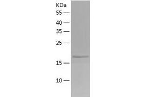 Western Blotting (WB) image for Dual Specificity Phosphatase 21 (DUSP21) (AA 1-190) protein (His tag) (ABIN7122711) (DUSP21 Protein (AA 1-190) (His tag))