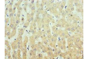 Immunohistochemistry of paraffin-embedded human liver tissue using ABIN7156335 at dilution of 1:100 (IRS1 antibody  (AA 1-160))