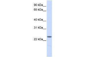 NPM2 antibody used at 1 ug/ml to detect target protein.