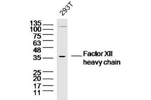 Human 293T cells probed with Factor XII heavy chain Polyclonal Antibody, unconjugated  at 1:300 overnight at 4°C followed by a conjugated secondary antibody at 1:10000 for 90 minutes at 37°C. (Factor 12 Heavy Chain (F12) antibody)
