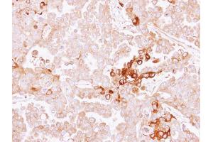Immunohistochemistry (IHC) image for anti-Alpha2 Antiplasmin (SERPINF2) (Center) antibody (ABIN2856732)
