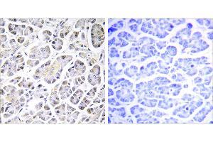 Peptide - + (ATP5G3 antibody)