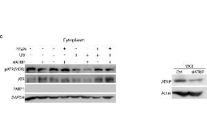 Protein phosphatase 2A (PP2A) dephosphorylates cytoplasmic pATR (S428) in a UV dose- and recovery time-dependent manner and is independent of ATRIP. (ATRIP antibody  (AA 1-260))