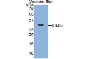 Western Blotting (WB) image for anti-DNA Topoisomerase II (TOP2) (AA 749-987) antibody (ABIN1860830) (TOP2 antibody  (AA 749-987))