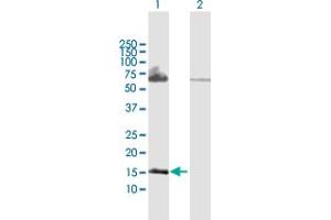 Western Blot analysis of PPP3R2 expression in transfected 293T cell line by PPP3R2 MaxPab polyclonal antibody. (Calcineurin B antibody  (AA 1-173))