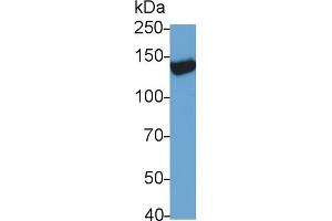 Detection of TRPM4 in Rat Serum using Monoclonal Antibody to Transient Receptor Potential Cation Channel Subfamily M, Member 4 (TRPM4) (TRPM4 antibody  (AA 1-400))