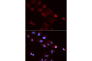 Immunofluorescence analysis of U2OS cells using SNRPE antibody (ABIN5973198). (SNRPE antibody)