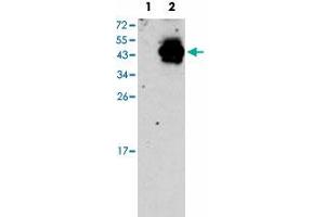 Western blot analysis of PDX1 (arrow) using PDX1 polyclonal antibody . (PDX1 antibody  (N-Term))