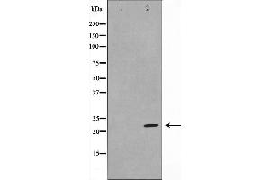 Western blot analysis on HeLa cell lysate using DIRA1 Antibody,The lane on the left is treated with the antigen-specific peptide. (DIRAS1 antibody  (C-Term))