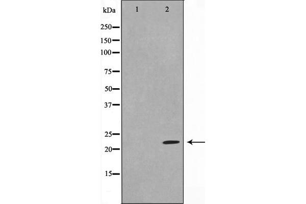 DIRAS1 antibody  (C-Term)