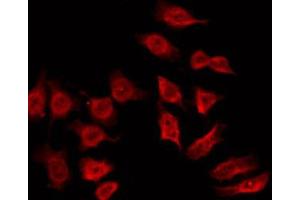 ABIN6272430 staining Hela by IF/ICC. (SH3BGR antibody  (Internal Region))