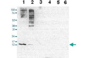 Western Blot analysis of (1) 25 ug whole cell extracts of Hela cells, (2) 15 ug histone extracts of Hela cells, (3) 1 ug of recombinant histone H2A, (4) 1 ug of recombinant histone H2B, (5) 1 ug of recombinant histone H3, (6) 1 ug of recombinant histone H4.