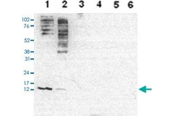 HIST1H4A anticorps  (acLys5, acLys8, acLys12)