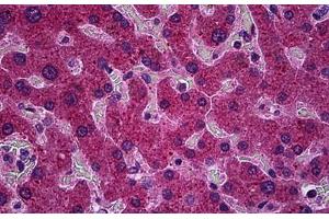 Human Liver: Formalin-Fixed, Paraffin-Embedded (FFPE) (PPM1A antibody  (AA 1-383))