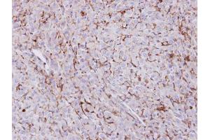 IHC-P Image Immunohistochemical analysis of paraffin-embedded U87 xenograft , using Trehalase, antibody at 1:100 dilution. (TREH antibody)