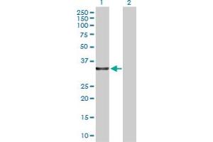 Western Blot analysis of LDHA expression in transfected 293T cell line by LDHA MaxPab polyclonal antibody. (Lactate Dehydrogenase A antibody  (AA 1-332))