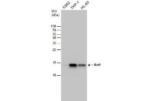 WB Image Iba1 antibody detects Iba1 protein by western blot analysis. (Iba1 antibody)