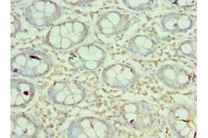 Immunohistochemistry of paraffin-embedded human colon tissue using ABIN7160218 at dilution of 1:100 (MORF4L1 antibody  (AA 1-100))