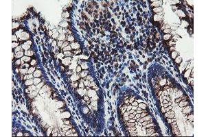 Immunohistochemical staining of paraffin-embedded Human colon tissue using anti-DPH2 mouse monoclonal antibody. (DPH2 antibody)