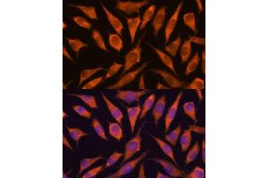 Immunofluorescence analysis of L929 cells using RP antibody (ABIN7270101) at dilution of 1:100. (RPAP3 antibody  (AA 17-241))