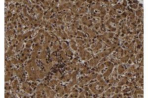 ABIN6277499 at 1/100 staining Human liver tissue by IHC-P. (ERCC1 antibody  (Internal Region))