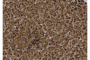 ABIN6277499 at 1/100 staining Human liver tissue by IHC-P.