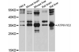 Western blot analysis of extracts of various cell lines, using ATP6V1E2 antibody (ABIN6292784) at 1:1000 dilution.