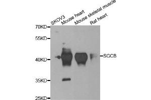 Western blot analysis of extracts of various cell lines, using SGCB antibody.