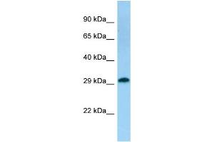 Host: Rabbit Target Name: TACO1 Sample Type: Fetal Kidney lysates Antibody Dilution: 1.