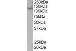 Western Blotting (WB) image for Zinc Finger, FYVE Domain Containing 20 (ZFYVE20) peptide (ABIN369019) (Zinc Finger, FYVE Domain Containing 20 (ZFYVE20) Peptide)