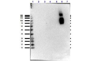 Western blot results of Mouse Anti-HbS Antibody. (HbBs (N-Term) antibody)