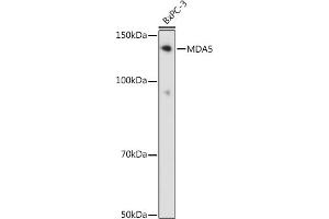 Western blot analysis of extracts of BxPC-3 cells, using MD antibody (ABIN7267950) at 1:1000 dilution. (IFIH1 antibody)