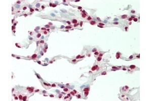 Human Lung: Formalin-Fixed, Paraffin-Embedded (FFPE) (CBX4 antibody  (AA 150-200))