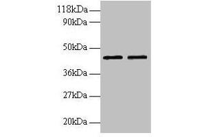 Western blot All lanes: B4GALT3 antibody at 2 μg/mL Lane 1: EC109 whole cell lysate Lane 2: 293T whole cell lysate Secondary Goat polyclonal to rabbit IgG at 1/15000 dilution Predicted band size: 44, 16 kDa Observed band size: 44 kDa