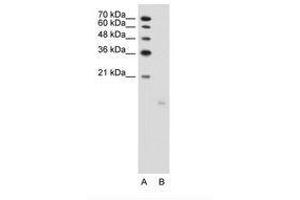 Image no. 1 for anti-PTPRF Interacting Protein, Binding Protein 1 (Liprin beta 1) (PPFIBP1) (AA 41-90) antibody (ABIN203505) (PPFIBP1 antibody  (AA 41-90))