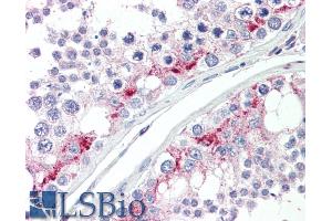 ABIN185335 (5µg/ml) staining of paraffin embedded Human Testis. (ZDHHC17 antibody  (C-Term))
