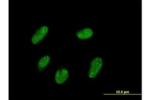 Immunofluorescence of purified MaxPab antibody to VENTX on HepG2 cell. (VENTX antibody  (AA 1-258))
