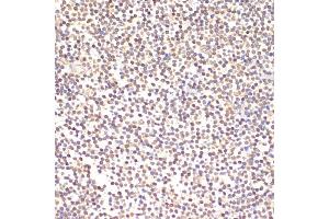 Immunohistochemistry of paraffin-embedded human tonsil using TI antibody (2517) at dilution of 1:100 (40x lens).