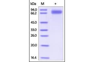 Human SIRP gamma, Fc Tag on SDS-PAGE under reducing (R) condition. (SIRPG Protein (AA 29-364) (Fc Tag))