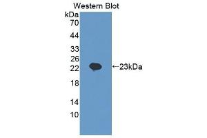 Detection of Recombinant SCEL, Human using Polyclonal Antibody to Sciellin (SCEL) (SCEL antibody  (AA 519-685))