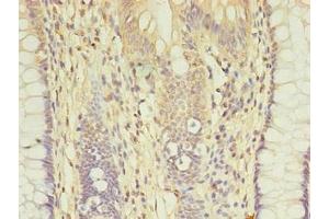 AGBL2 antibody  (AA 10-270)