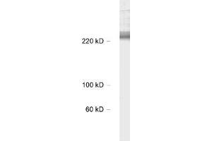 antibody dilution: 1 : 1000, sample: rat hippocampus lysate