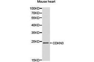 Western Blotting (WB) image for anti-Cyclin-Dependent Kinase Inhibitor 3 (CDKN3) antibody (ABIN1871769) (CDKN3 antibody)