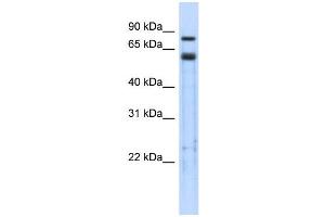WB Suggested Anti-TRIM9 Antibody Titration:  0.