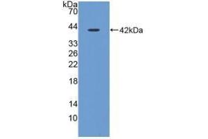 Detection of Recombinant CST3, Porcine using Polyclonal Antibody to Cystatin C (Cys-C) (CST3 antibody  (AA 42-127))
