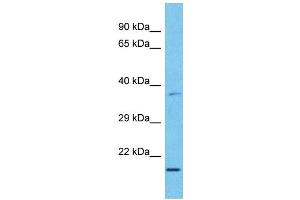 Host:  Rabbit  Target Name:  MXD3  Sample Type:  Esophagus Tumor lysates  Antibody Dilution:  1. (MXD3 antibody  (C-Term))